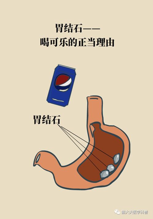 胆结石 胃结石 身体里突然多了这些 石头 怎么办