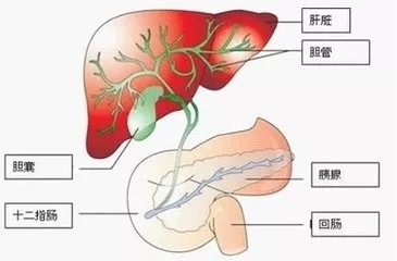 【结石案例】老太胆囊切除八年后,再次结石入院!