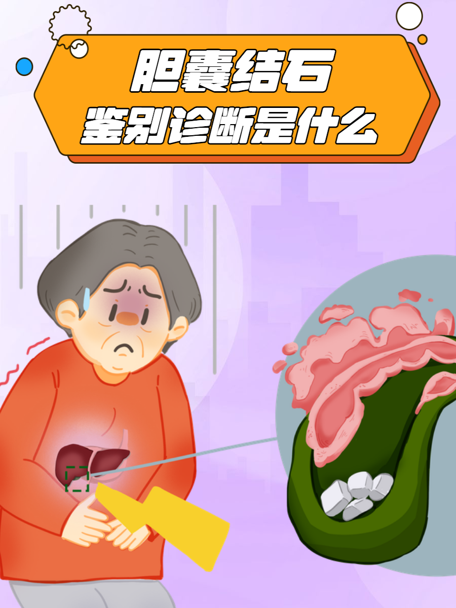 胆囊结石鉴别诊断的全面解析