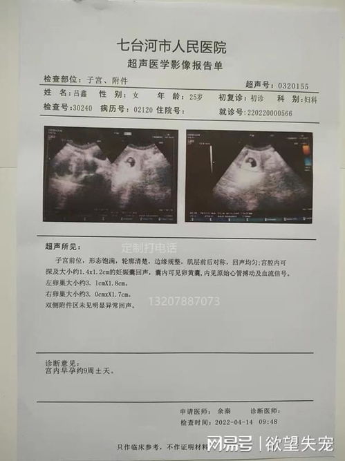 细节不容忽视 从哮喘到胆结石的诊断详解与病历样板分享