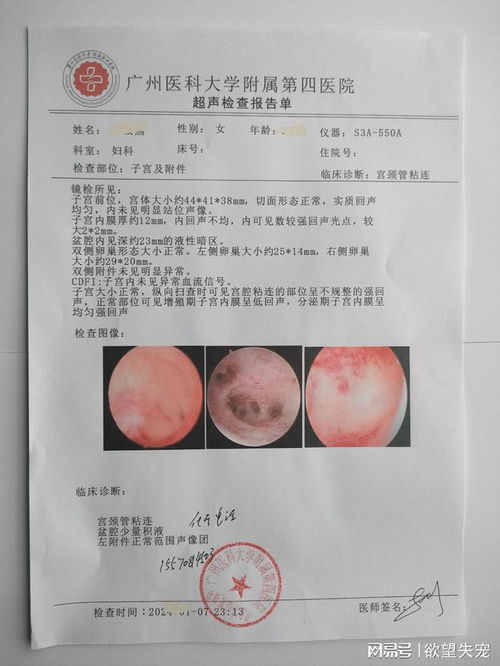 关于胆囊炎与胆结石住院病历及病假管理的重要性